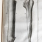 1757 SURGERY ANATOMY ILLUSTRATED antique Memoires l'Academie Royale de Chirurgie