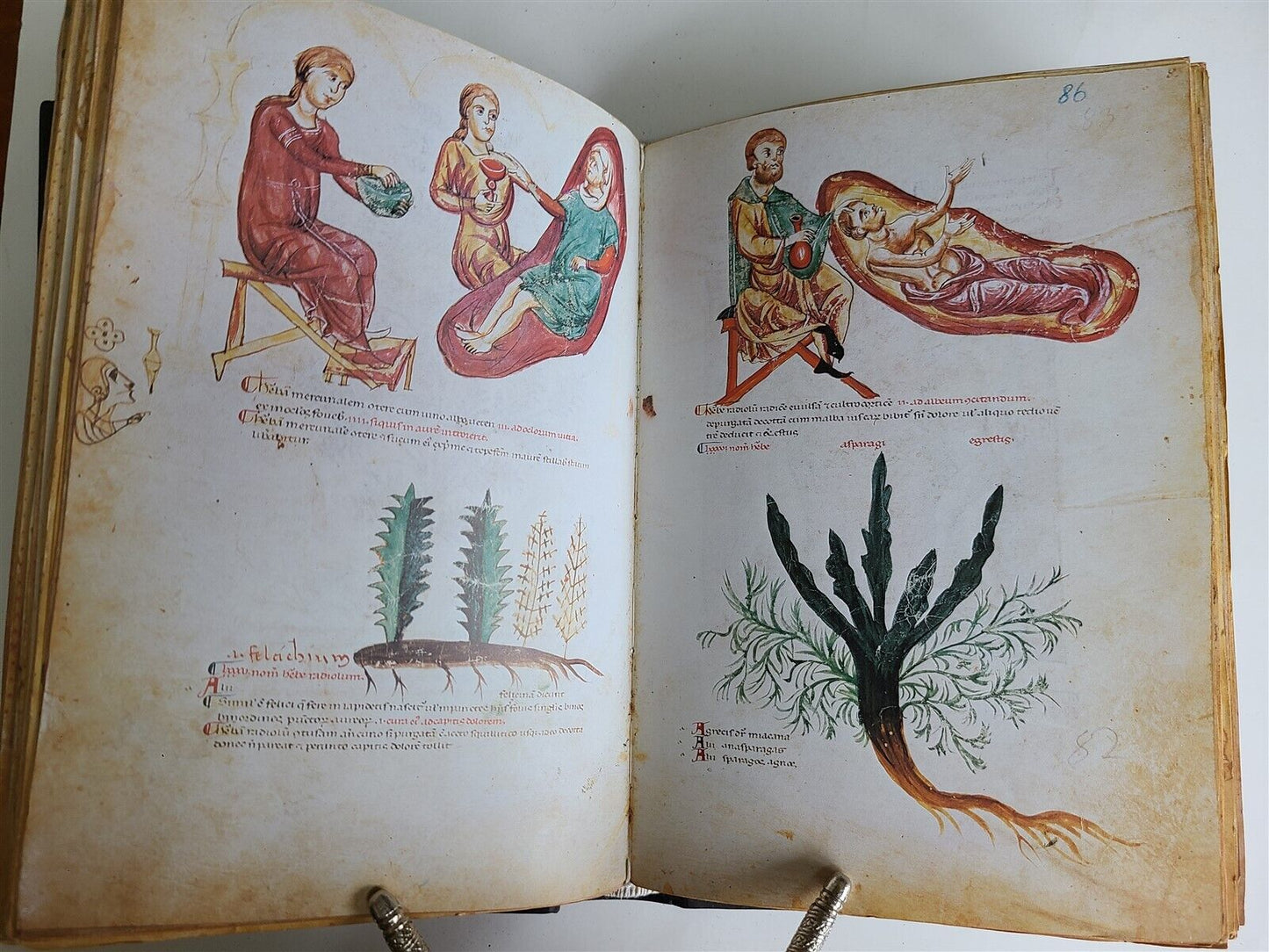 1971 FACSIMILE EDITION Medicina antiqua illustrated 2 VOLUMES